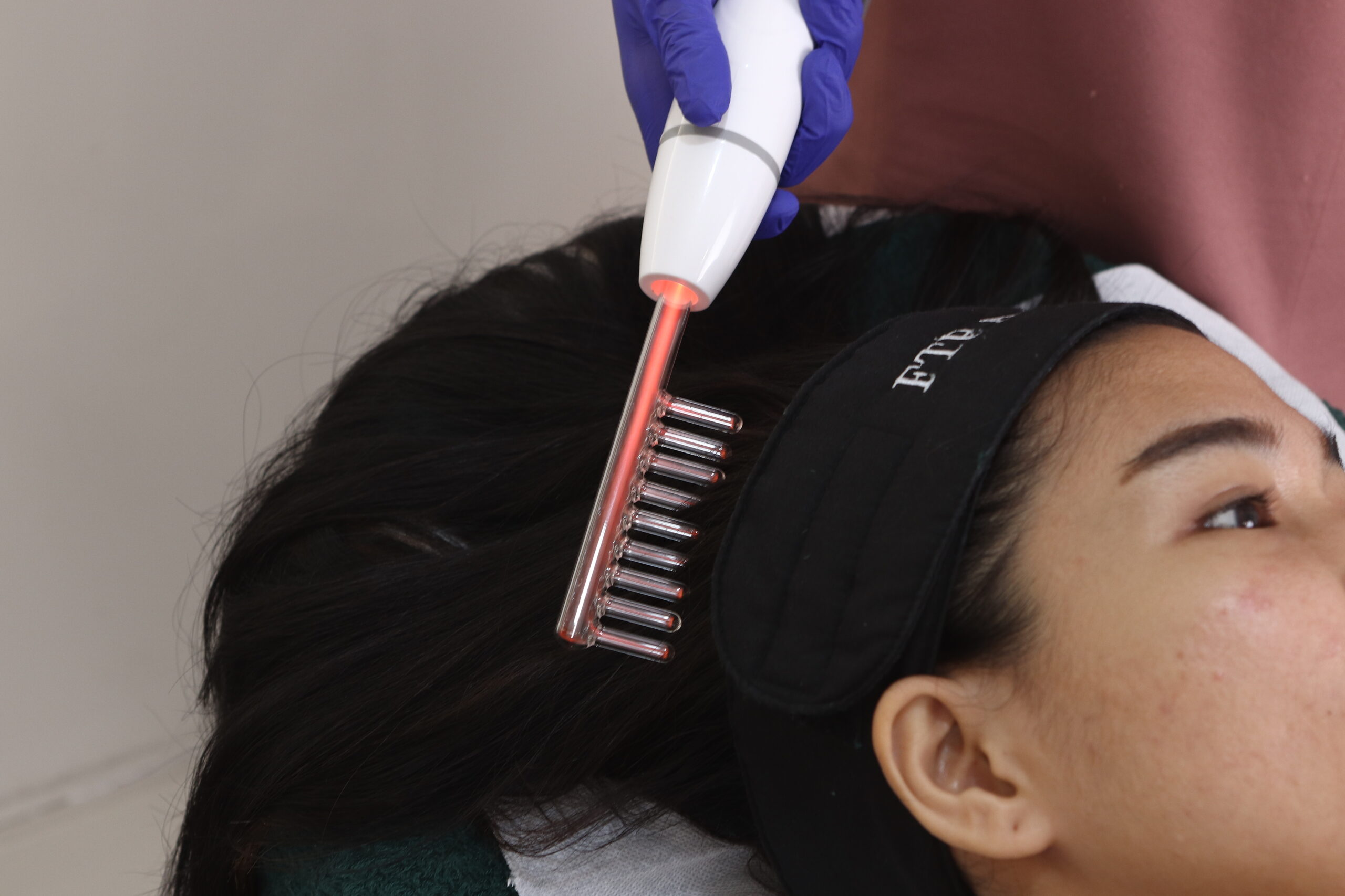 Hair Growth Treatment