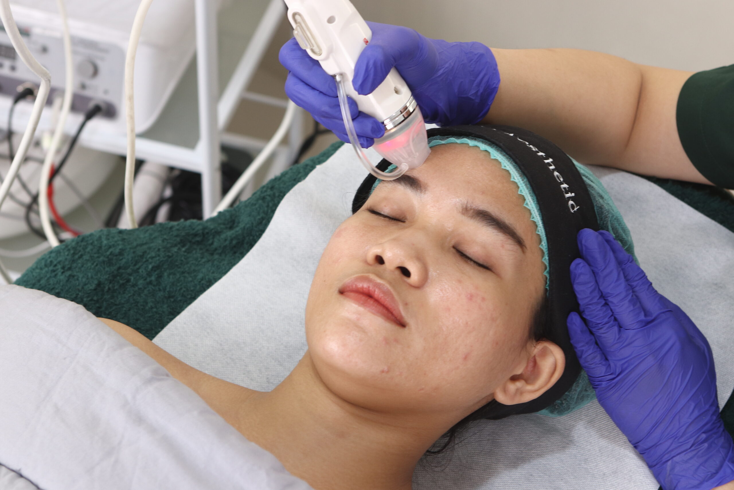 Treatment Collagenesis RF