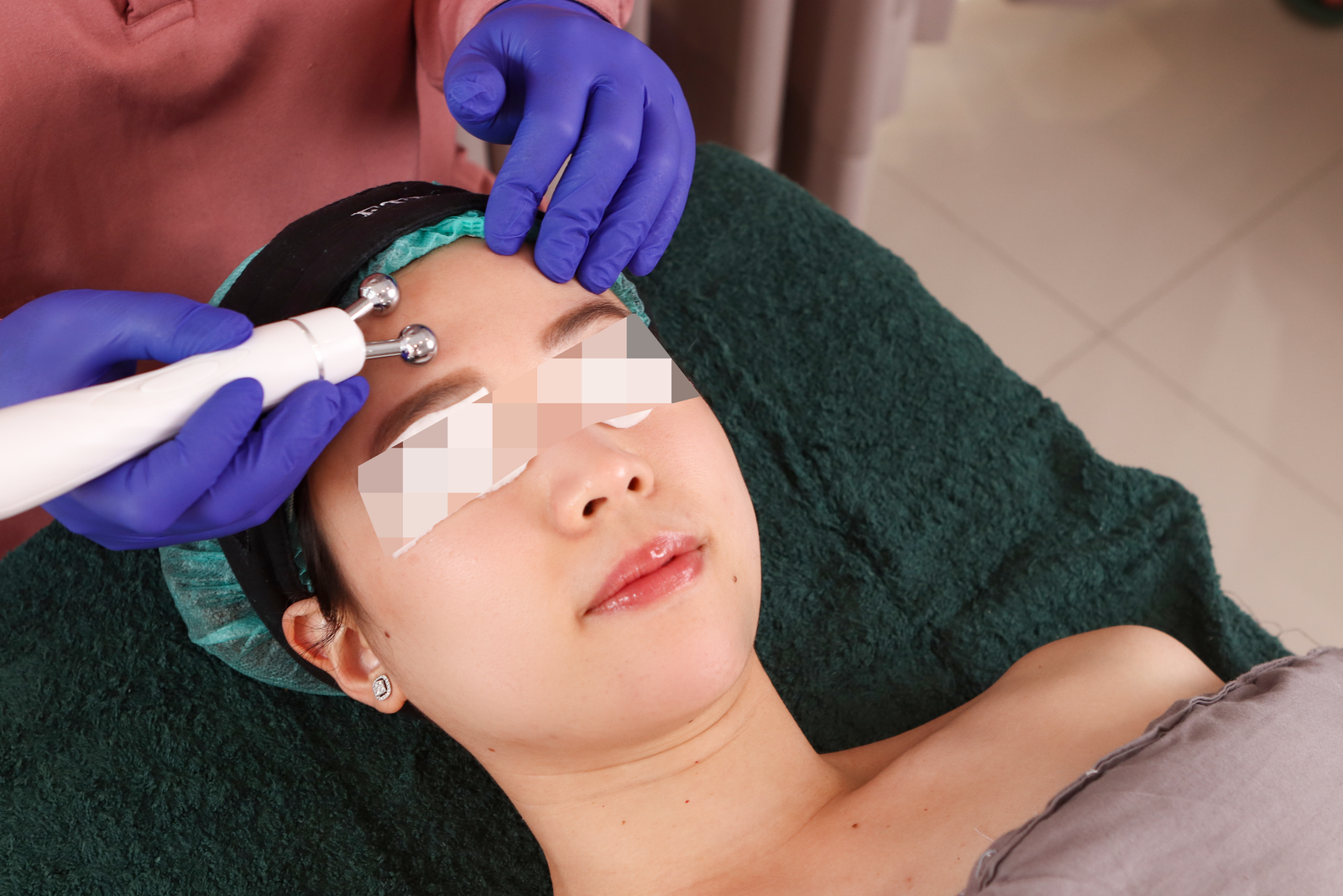 Diamond Peel
