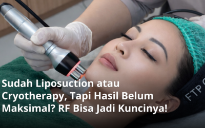 Sudah Liposuction atau Cryotherapy, Tapi Hasil Belum Maksimal? RF Bisa Jadi Kuncinya!