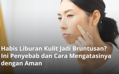 Habis Liburan Kulit Jadi Bruntusan? Ini Penyebab dan Cara Mengatasinya dengan Aman